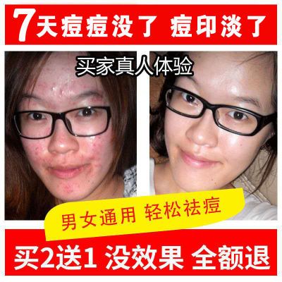中药草本快速祛痘膏去痘痘印膏霜男女学生强效去除青春痘粉刺产品