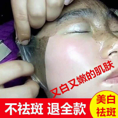 【湖南卫视推荐】99%去除各种顽固斑点正品美白草本中药祛斑霜30g
