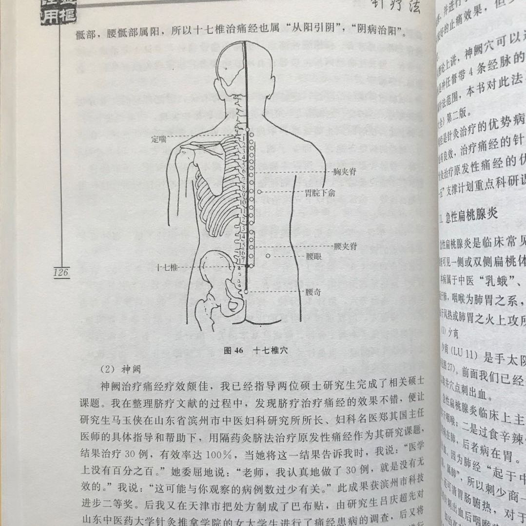 【正版现货】一针疗法灵枢诠用高树中著中医学书籍入门济南出版社