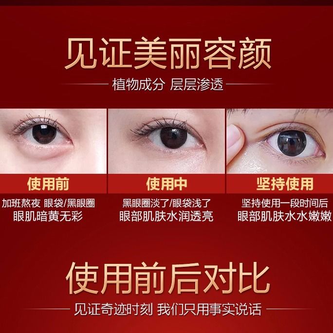 嫒珀眼霜去黑眼圈眼袋脂肪粒提拉紧致淡皱纹细纹眼纹保湿补水30g