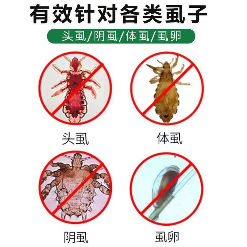 百部酊儿童孕妇去虱子药一扫光灭杀头虱虱卵体虱阴虱除螨虫虱必清