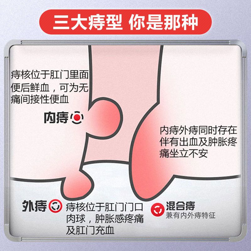 【痔疮药特效】痔疮膏痔疮消肉球特效便血内痔外痔混合痔止痛脱肛