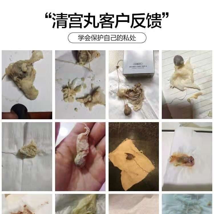 清宫丸正品【8粒 8支凝胶】清宫排毒丸盒装妇科炎症用品宫颈糜烂