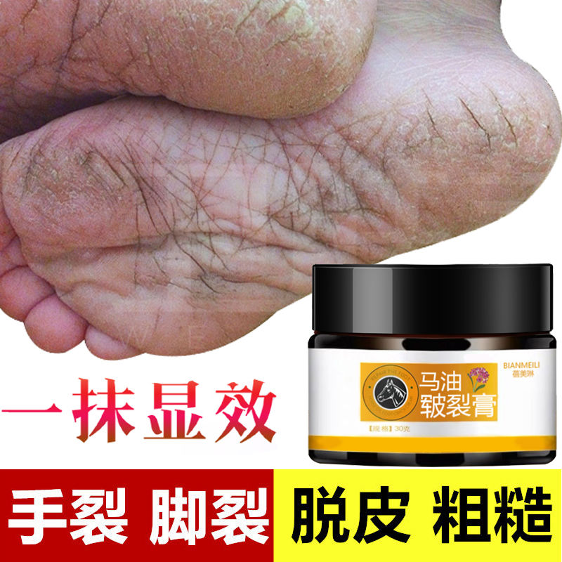 一抹显效手脚干燥开裂脱皮脚后跟干裂脚裂膏防裂膏保湿皲裂膏