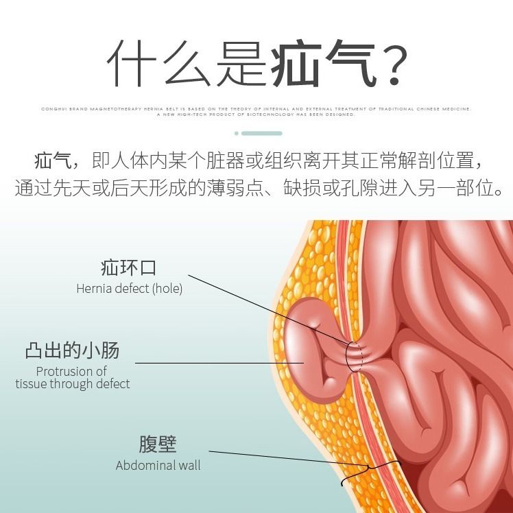 孕妇中老年成人老人医用脐疝袋大肚脐 凸肚脐疝贴疝气带脐疝带