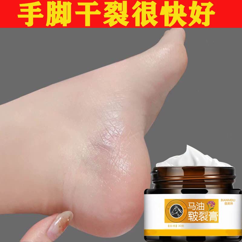 手脚干裂粗糙脱皮皲裂膏马油保湿滋润膏冬季护手护脚膏