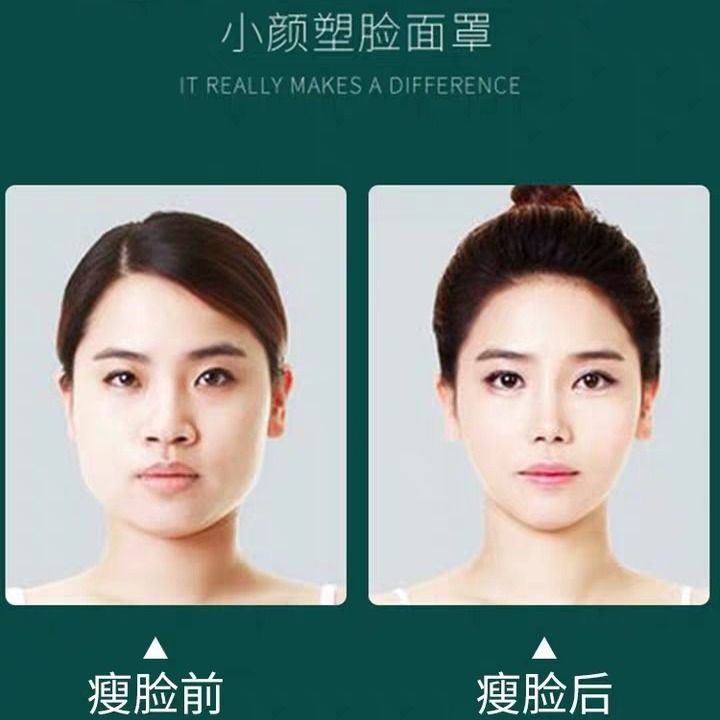 瘦脸神器绷带v脸提拉学生女法令纹瘦咬肌双下巴美容仪器脸部按摩