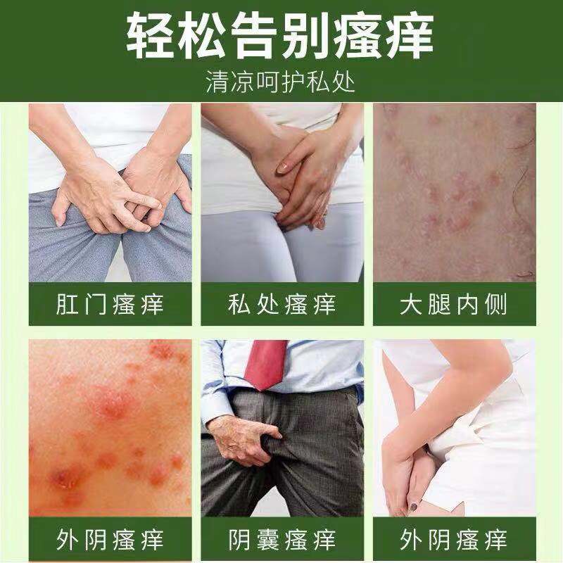 肛痒灵止痒治痔疮药膏肛门肛周屁眼私处外阴痒药皮肤瘙痒湿疹药膏