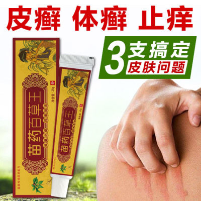 三盒装苗药百草王 百草止痒膏止痒药膏瘙痒湿疹膏皮肤过敏药膏25g