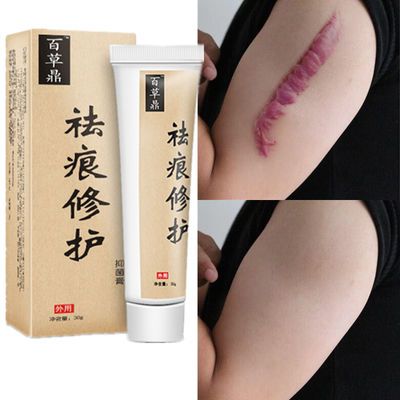 【去疤神器疤痕克星】去疤痕产品去妊娠纹修复霜伤疤膏烧烫伤男女