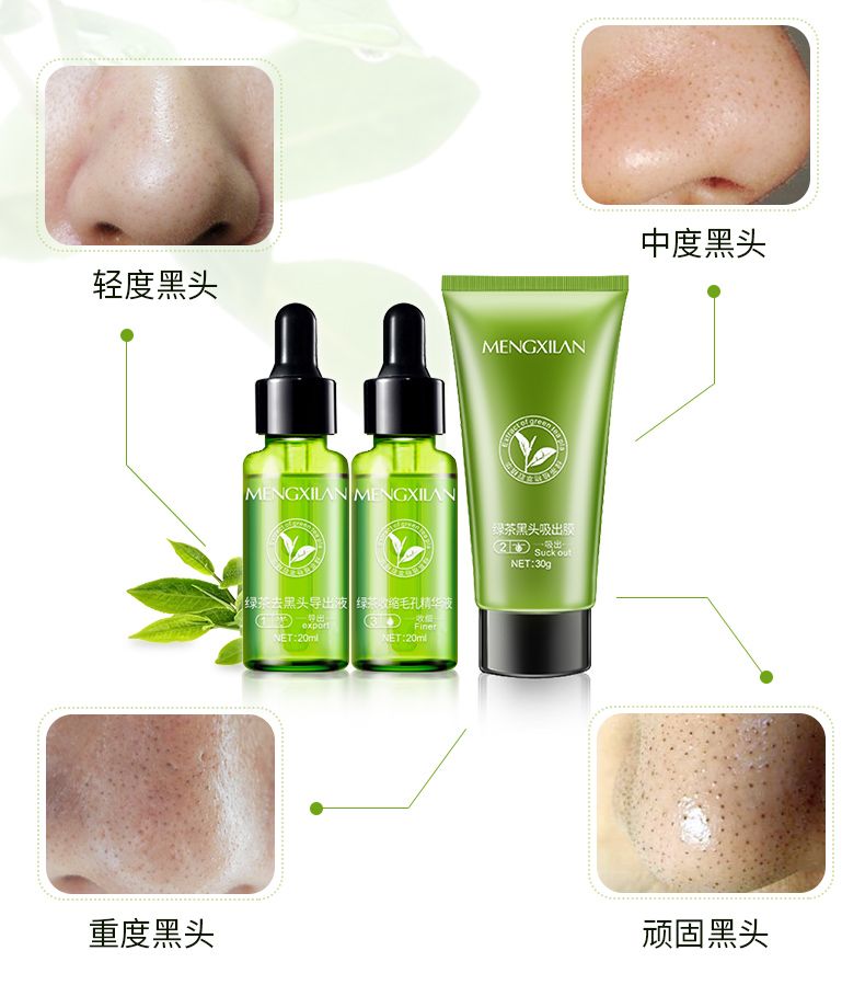 粉刺夹去黑头套装 be1e5119-befd-4f79-87fd-0e2397d68dd1.jpg