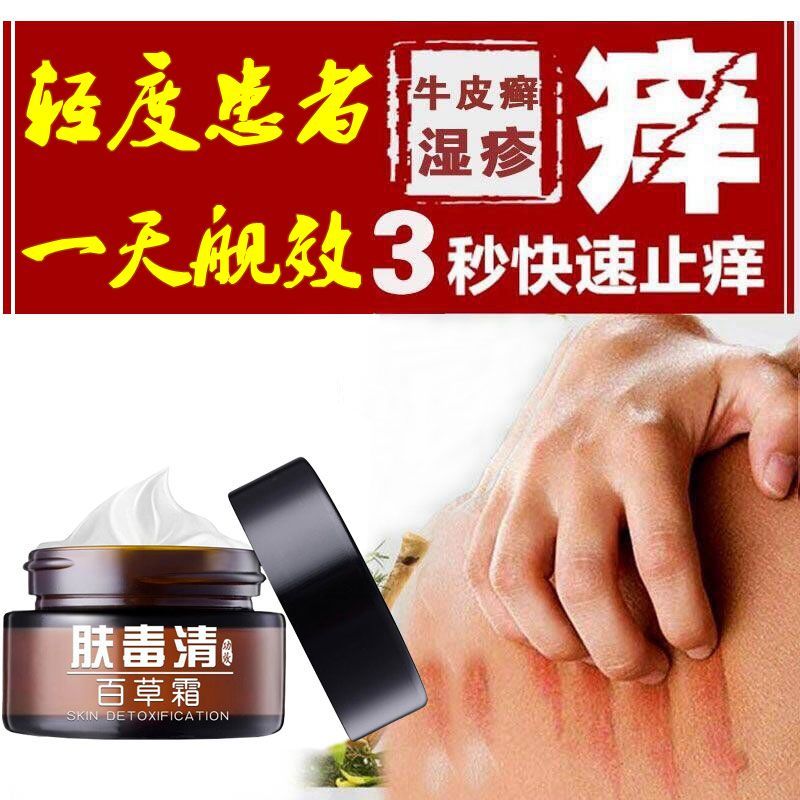 膚毒清百草霜銀屑病牛皮癬專用濕疹皮炎頭皮癬體蘚手足癬止癢外用