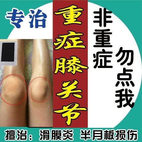 滑膜贴膝盖疼痛积水半月板撕裂风湿性关节炎老寒腿止痛贴黑膏药贴