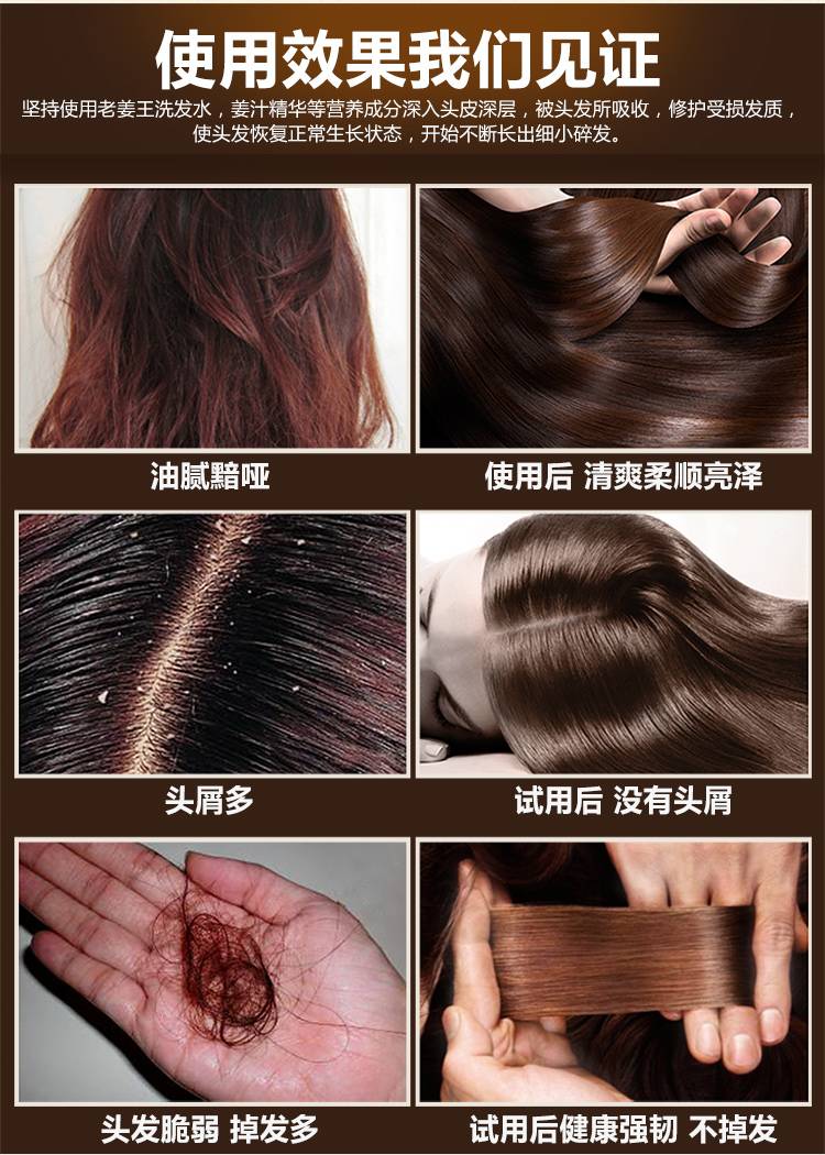 如何防脱发及生发密发方法 70