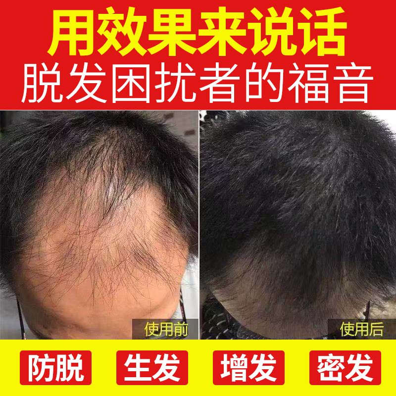 eb59e136-f8a6-485c-aea2-670485d4318d.jpg