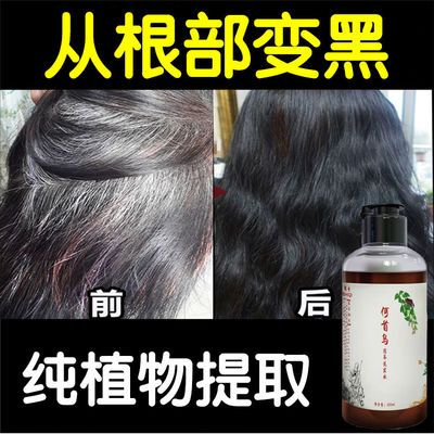自然流产