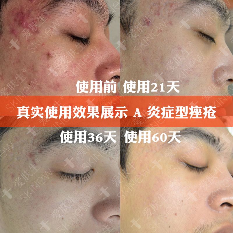 c585e75c-36bc-4d1d-97a4-eb7820496d32.jpg