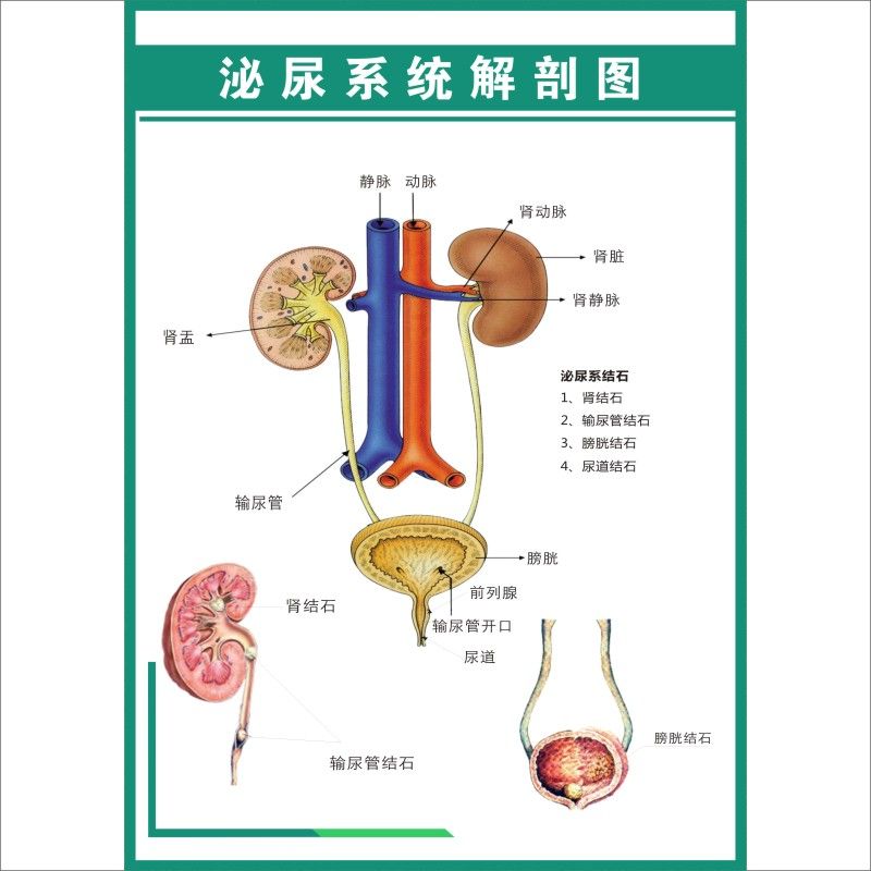 医院人体泌尿系统结构示意图海报泌尿系结石挂图泌尿系统解剖图