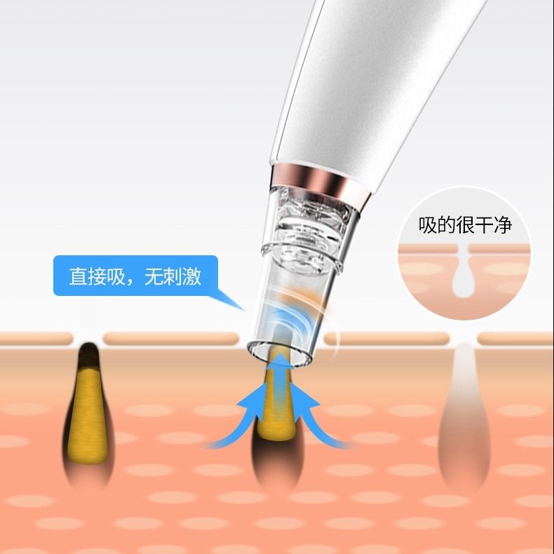 粉刺清洁器 38c7c10f-7ba7-4691-8223-1ba41c42a759.jpg