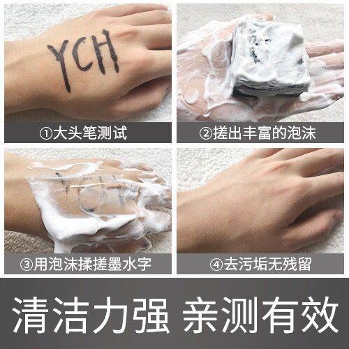 粉刺夹去黑头正品 5bd0e9a3-a99e-461c-a781-5763c36ca918.jpg