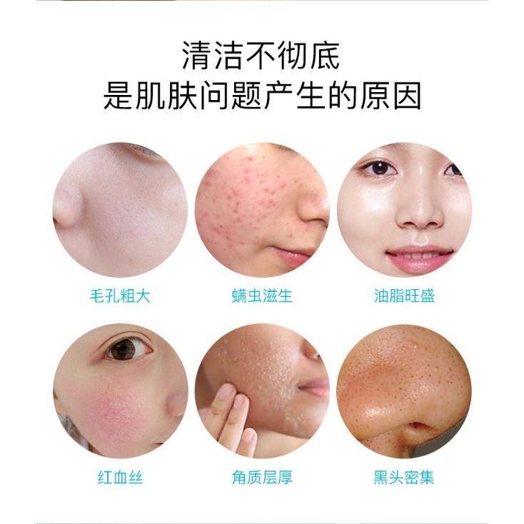 皮肤怎么去螨虫最好 953be934-8ad4-4a3c-97d6-c243b0b40a92.jpeg