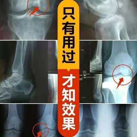 风湿肩周炎 腰椎间盘突出颈椎病腰腿疼痛坐骨神经痛 专用黑膏药贴