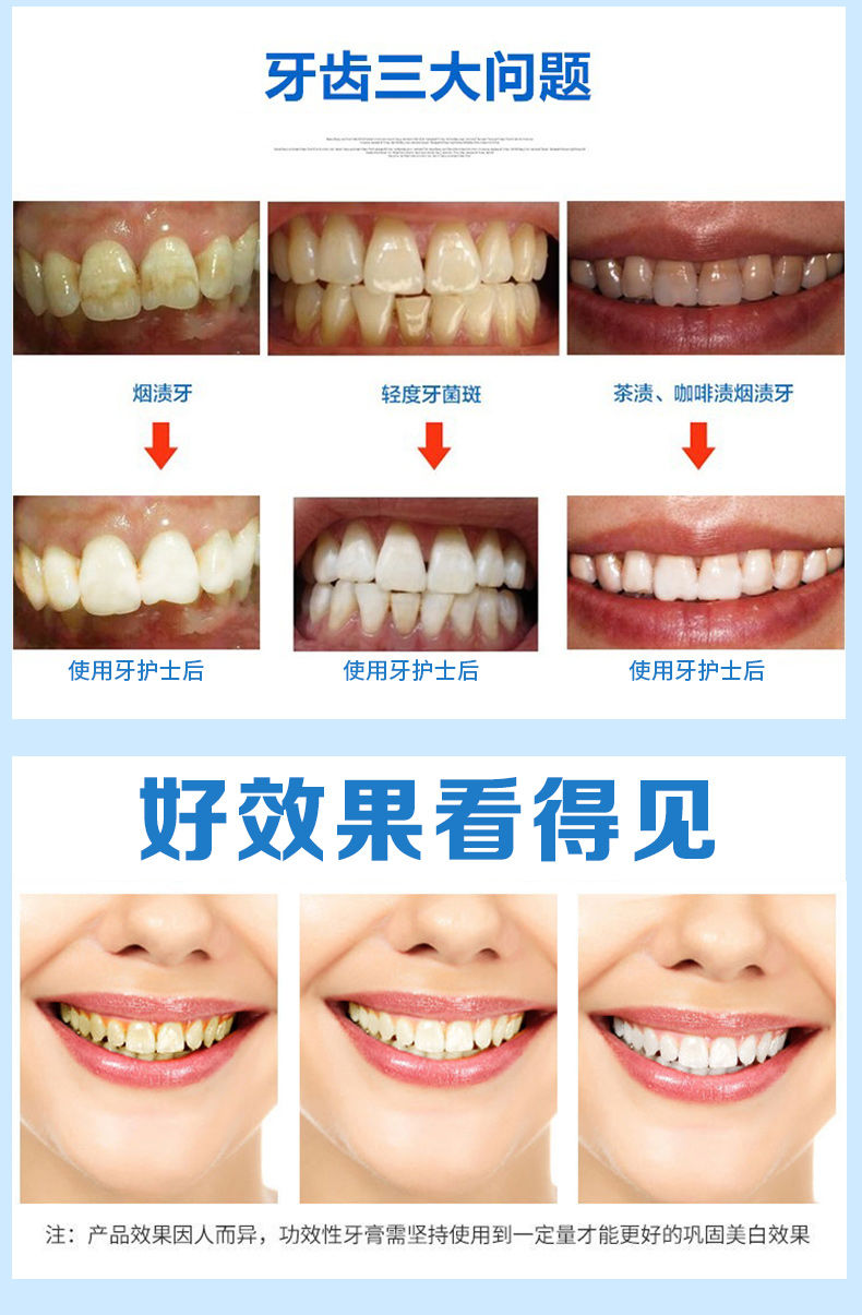 成人口臭_宝宝奶香变为 口臭 ,妈妈别掉以轻心(3)