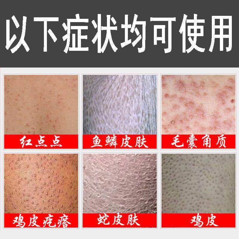 真正的鸡皮疙瘩图片(看了必定起鸡皮疙瘩的图片)