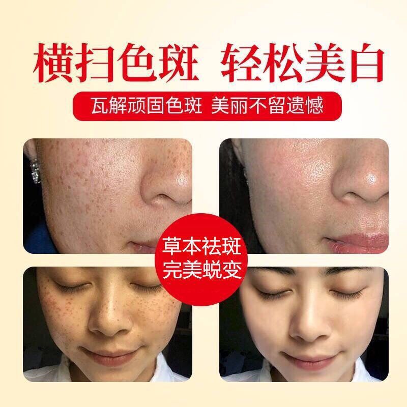 皮肤修复需要多长时间见效 a49e30d3-c81c-4dcd-8634-42d3c22923ae.jpg