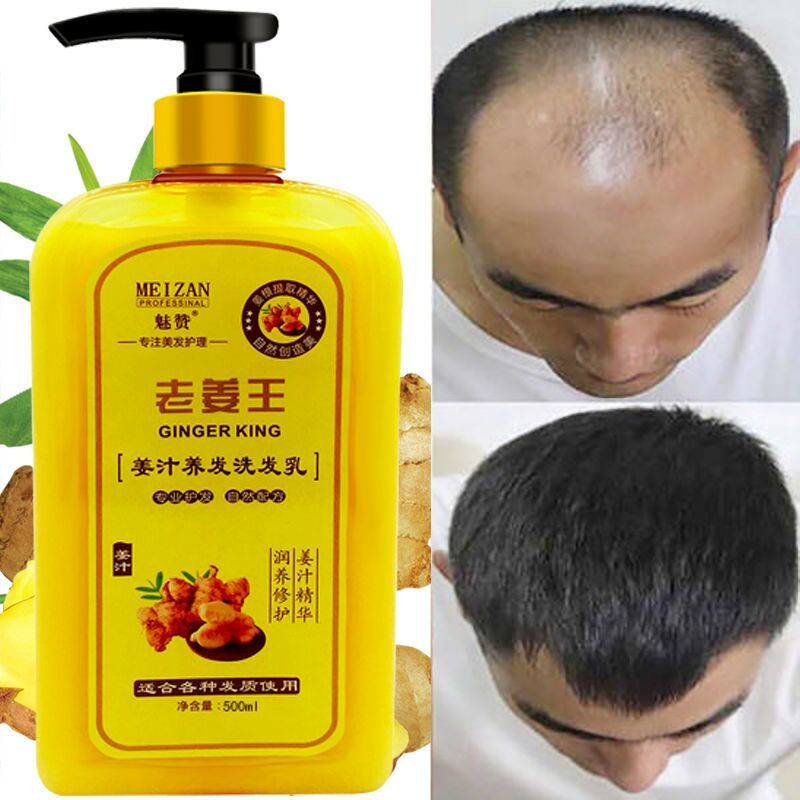 b0f235e8-f8af-46a8-8fce-3c37fade142c.jpg