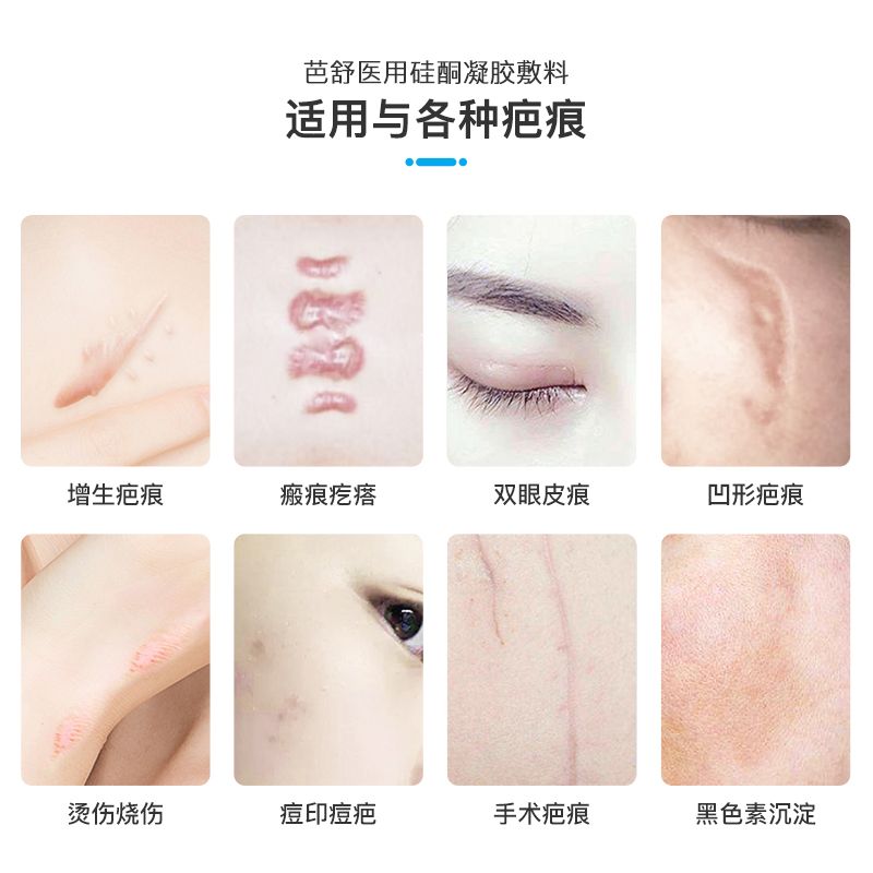 手术疤痕修复的价格 fd7efc09-6035-4f1a-8de4-7007cf927abe.jpg