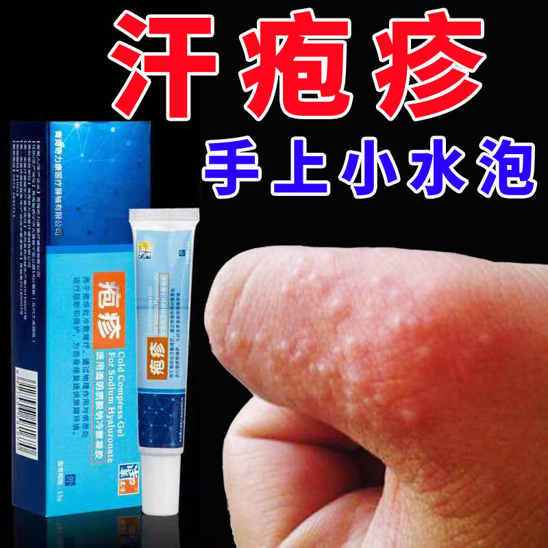 手上起小水泡痘豆汗疱疹鹅掌风出汗红点止痒涂抹膏不良性湿疹脱皮