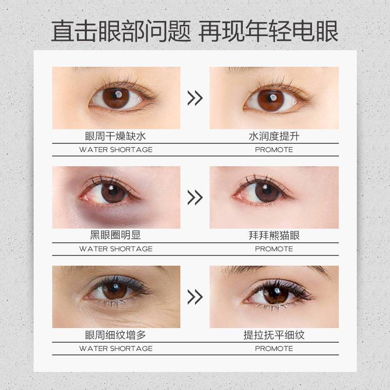怎样缓解眼部疲劳保护眼睛 b453a4b7-8cdd-421b-a761-e86046f2f2b0.jpg