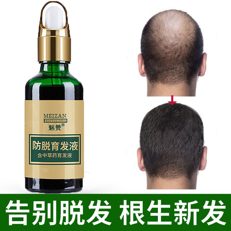 用什么方法可以快速生发 d6fc8dd2-43d3-406f-9245-5b342eedf84a.jpg