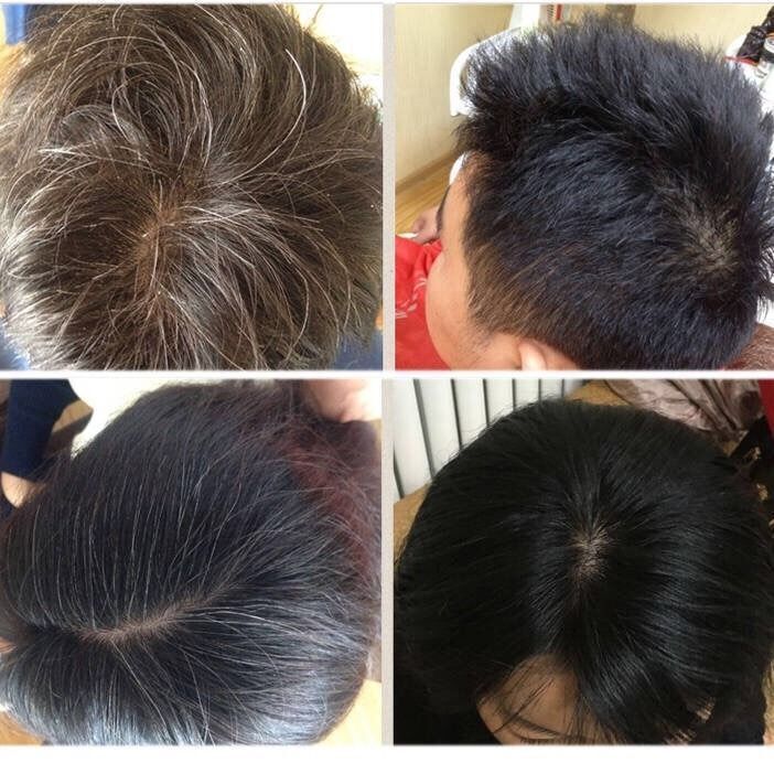 何首乌中草药洗发水白头发转黑发中老年产后白发乌发防脱养发液zzh