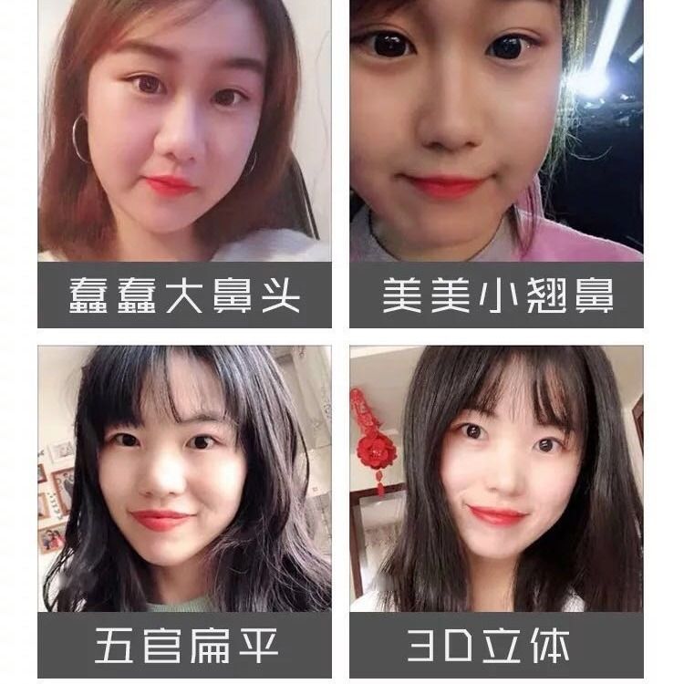 怎么让鼻梁变高变挺和鼻翼缩小 e5a3d946-9c89-4463-ac56-e7832280b2b9.jpg