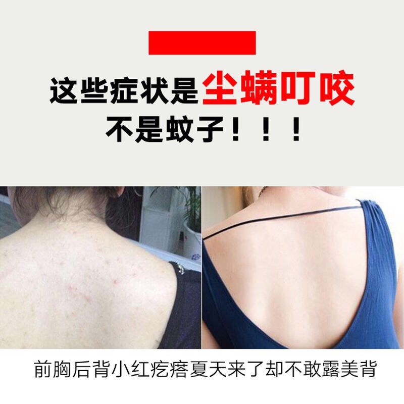 床上螨虫怎么去除最彻底 f8844aea-d14a-4921-a274-4f21631bf213.jpeg
