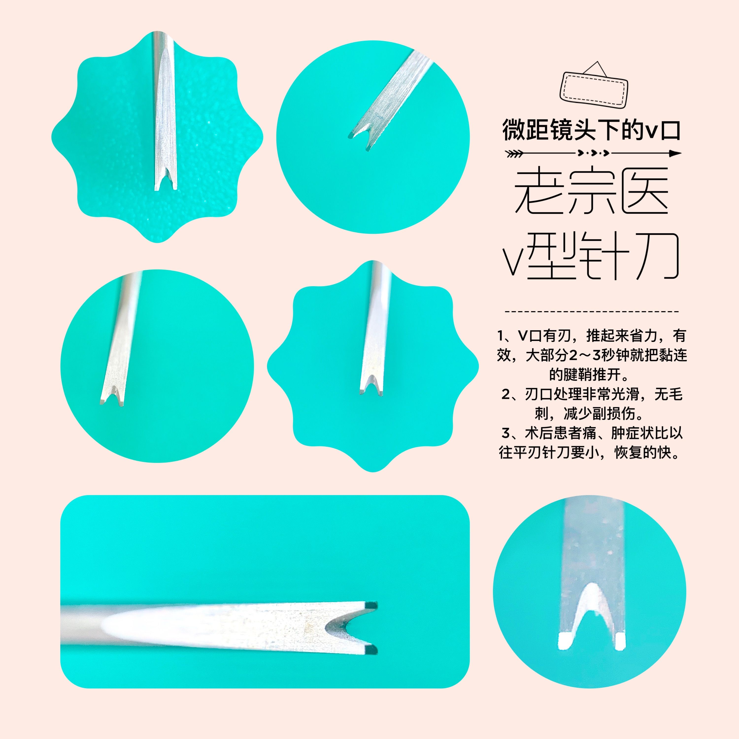 老宗医v型针刀/一次性小针刀/腱鞘炎专用月牙针刀1.2*50mm50支装