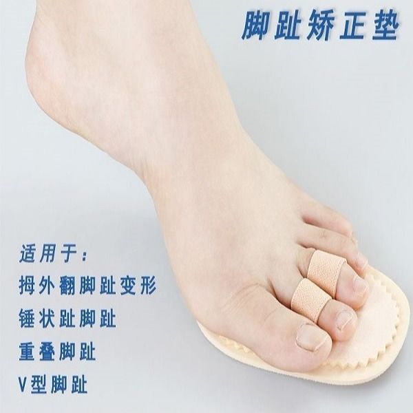 大小脚趾头重叠趾脚趾弯曲分趾器分离爪状趾锤状指矫形变形矫正器