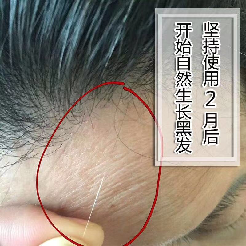 不长白头发的药 0358b68e-5b65-436c-b703-1112eaa08cb5.jpg