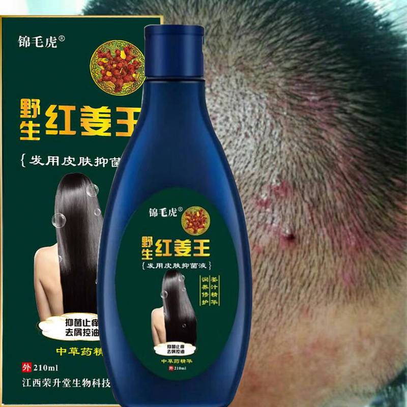 去屑止痒洗发水去屑毛囊焱防脱发控油洗发液头皮屑头痒中药洗头膏