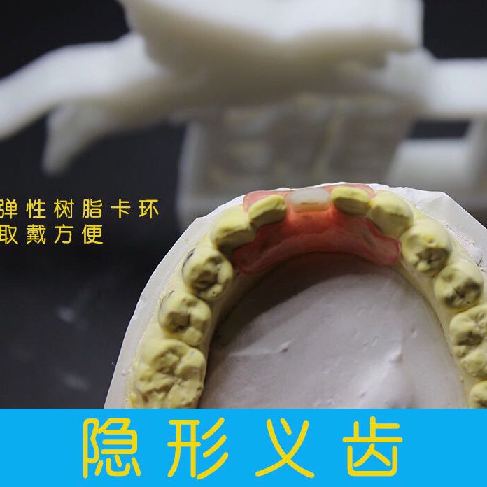定制隐形义齿吸附性全口活动牙老年取戴临时套树脂牙模制作包