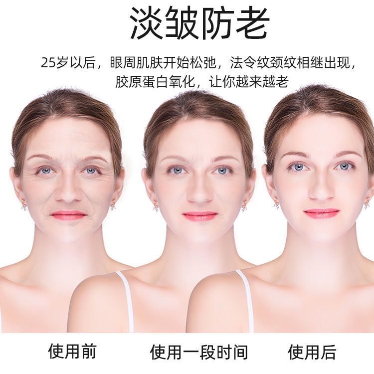 减少法令纹神器 6a8c5f53-ef42-4c8c-ac64-64365c7068a5.jpeg