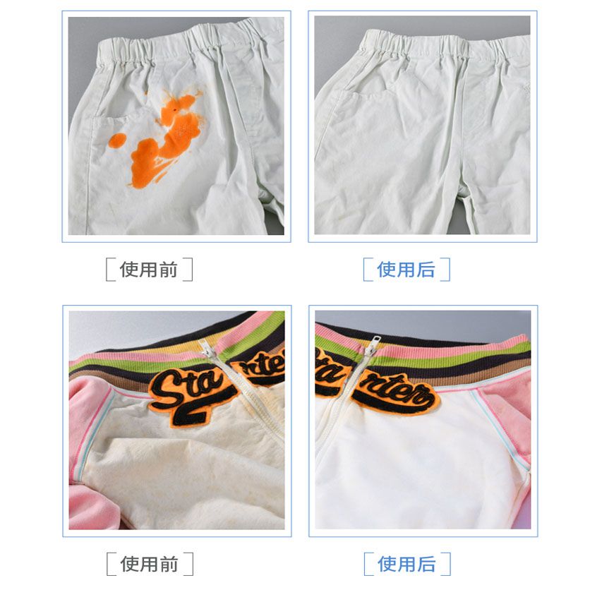衣服发黄怎么恢复 3ea38cc3-3b7c-4173-b5b7-ae60f4b65e72.jpg