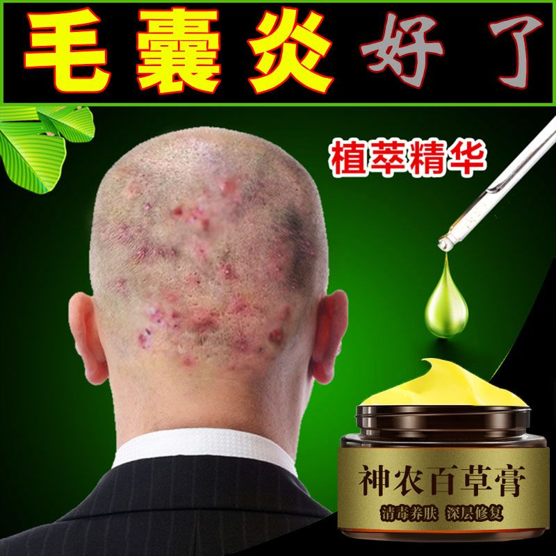 关于若隐若现的鸡皮疙瘩的信息 关于若隐若现的鸡皮疙瘩的信息