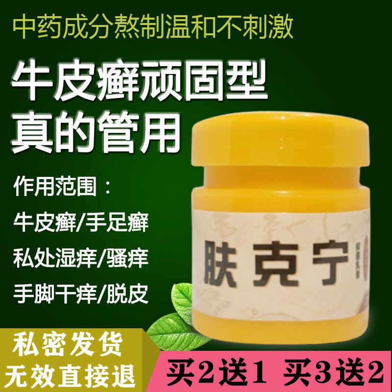 肤克宁治牛皮癣银屑病特效止痒乳膏脚气手癣皮肤瘙痒肛门湿痒软膏