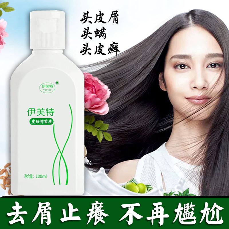 去屑止痒洗发水除螨头皮癣头癣头皮痒藓去头屑克星控油头皮屑神器