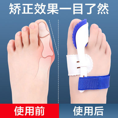 拇指外翻矫正器分大母脚趾头足改善纠正大脚骨可以穿鞋男女士分离