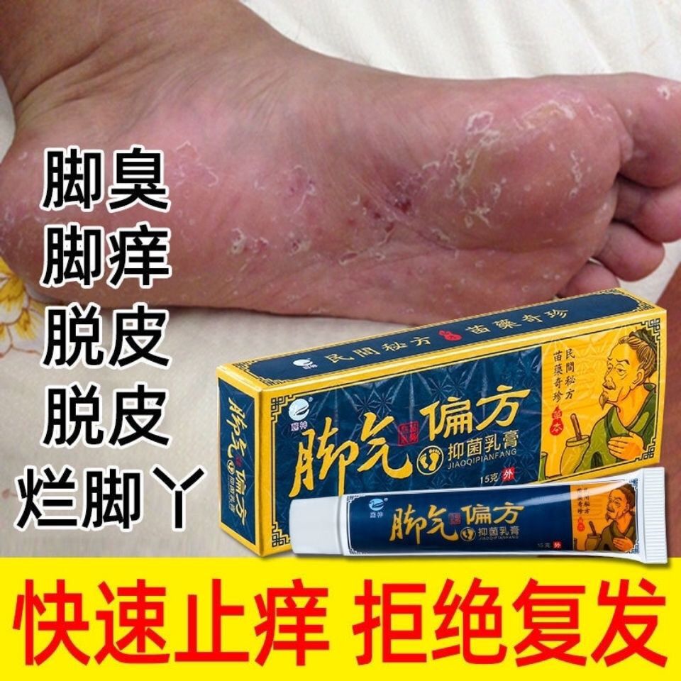 脚气偏方苗脚气膏脚痒治脚气治脚臭脱皮烂脚水泡烂脚丫祛痒祛脱皮