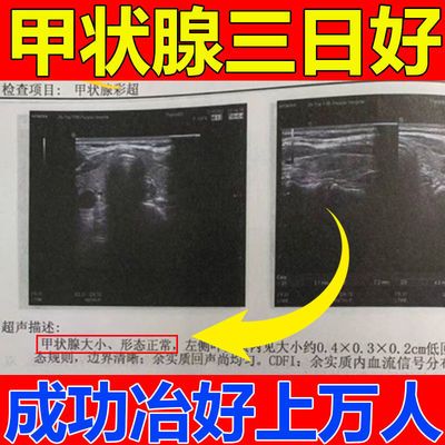 32730/【冶好上万人】甲状腺结节贴功能亢进甲亢甲减脖子粗大眼突结节贴